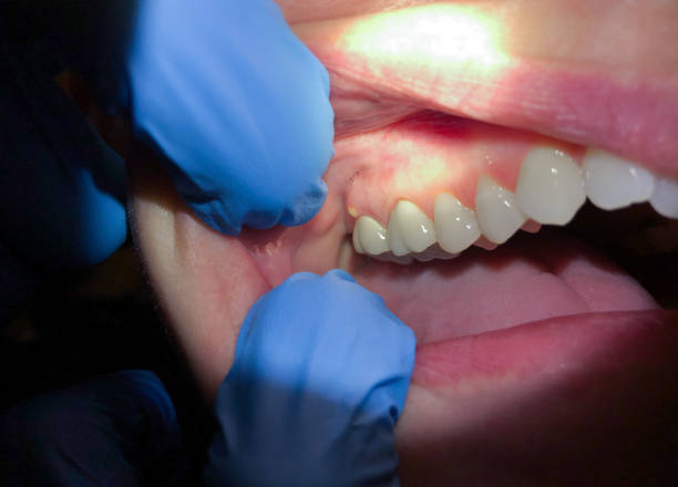 Best Walk-In Emergency Dentist in Evansburg, PA