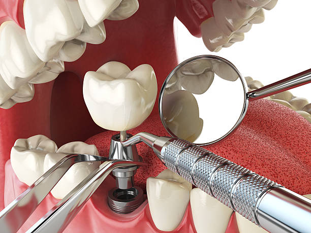 Best Weekend Emergency Dentist in Evansburg, PA